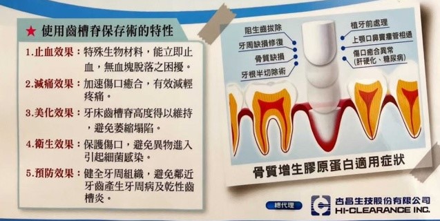 膠原蛋白敷料示意圖