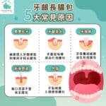 牙齦膿包怎麼來的？5大原因揭曉​