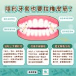 矯正小教室，隱形牙套也要拉橡皮筋？