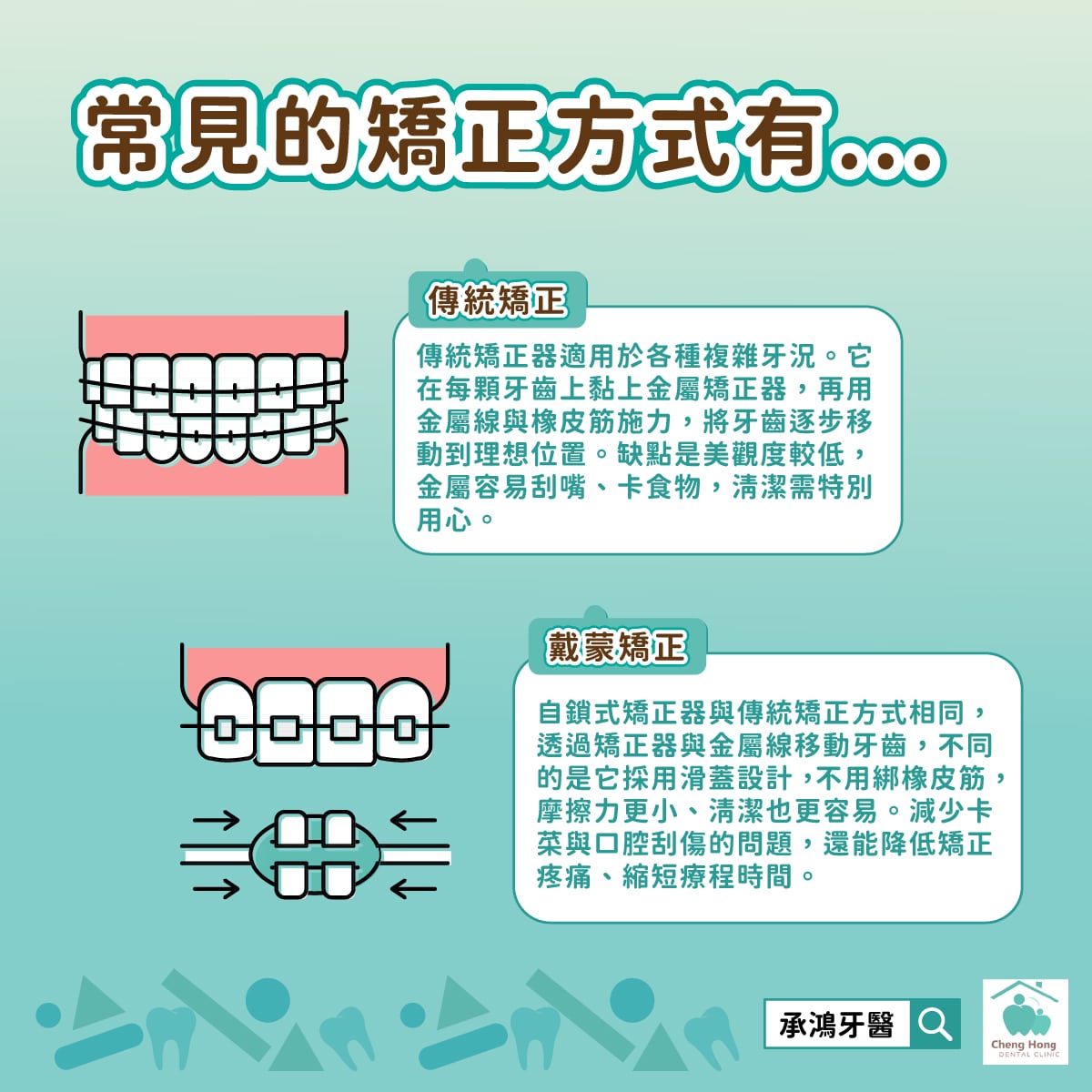傳統矯正、戴蒙矯正