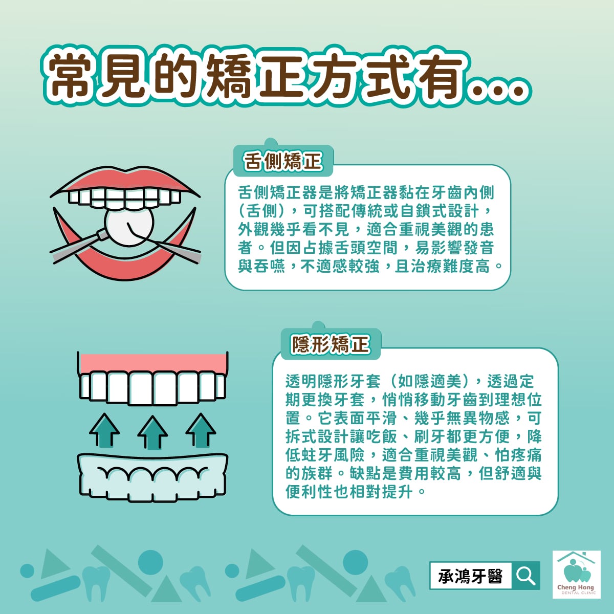 舌側矯正、隱形矯正