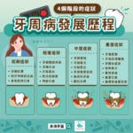 牙周病發展歷程，4個階段的症狀