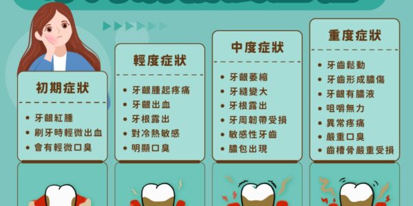 牙周病發展歷程，4個階段的症狀 5 (2)