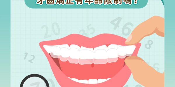 矯正小教室，牙齒矯正有年齡限制嗎？ 5 (3)
