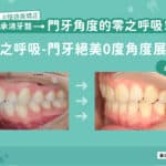 零之呼吸：門牙絕美0度角度展現
