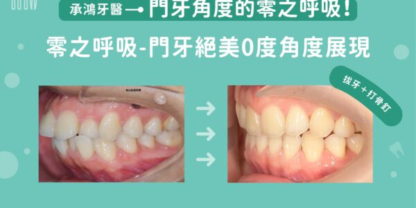 零之呼吸：門牙絕美0度角度展現