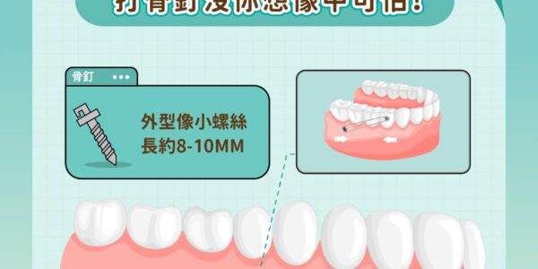 矯正小教室，打骨釘沒你想像中可怕！