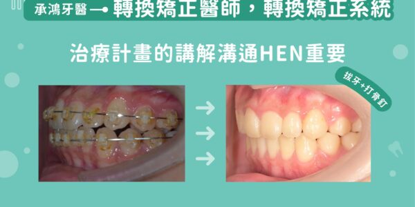 轉換矯正醫師，轉換矯正系統