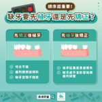 缺牙要先植牙還是先矯正?順序超重要