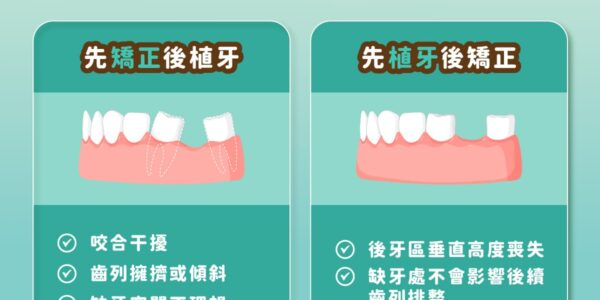 缺牙要先植牙還是先矯正?順序超重要