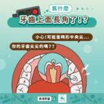 為什麼牙齒上面長角了！？