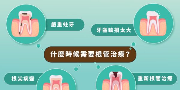 什麼時候需要根管治療？這些牙齒警訊別忽視！