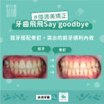 牙齒飛飛 Good Goodbye