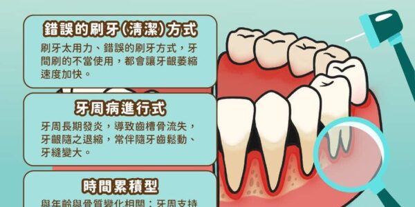 以為牙齦萎縮只是牙齦變少？常見 3 種牙齦萎縮原因