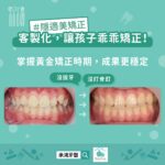 客製化，讓孩子乖乖矯正！掌握黃金矯正時期，成果更穩定