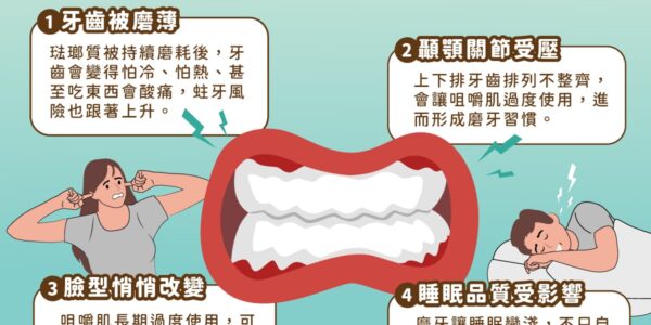 你必須知道！長期磨牙的4大風險