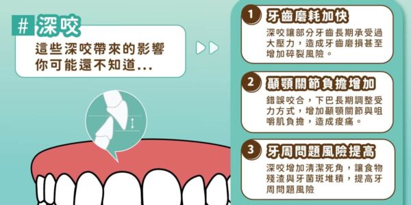 上排牙齒蓋住比較多，只是「深咬」需要矯正嗎？台中蔡宜廷醫師解析 4 大隱藏危機與矯正對策