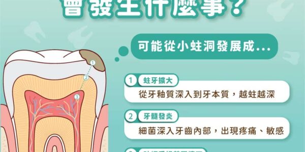 蛀牙突然不痛了真的代表好了嗎？台中北區承鴻牙醫解析蛀牙拖延的潛在危機